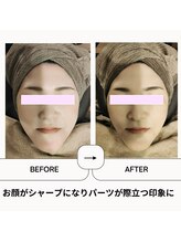 ボディトーン(bodytone)/小顔フェイシャル
