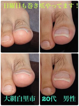 巻き爪じゅん 船橋店/日曜も巻き爪施術お願い出来る？