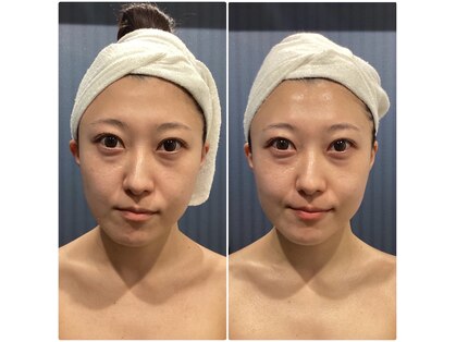 トリニティ 銀座店(TRINITY)の写真