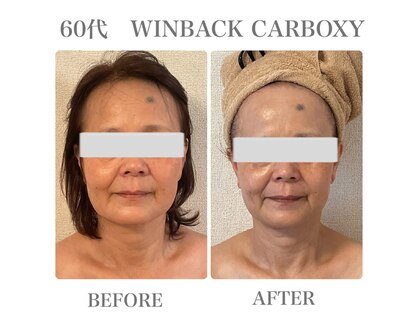 イリゼ(IRISER)の写真