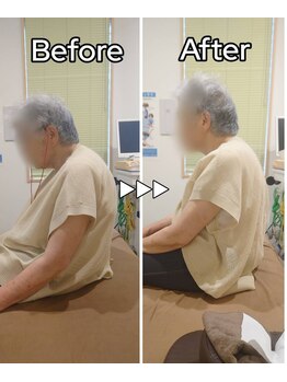 美波整体院 矢巾院/姿勢before→after