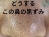 【学割U24】毛穴エクストラクション ¥12000→¥6000