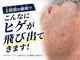 ダイアモンドベリーの写真