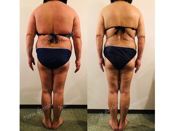 クレナ イオンゆみ~る鎌取店(Crena)/マイナス30キロ達成☆