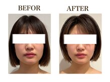 ルアバイアロ(Lua by Alo's)/大人気小顔コース