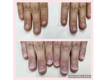 ネイルアンドビューティーサロン ブルーム(nail&beautysalon BLOOM)の雰囲気（まるで自爪仕上げもできます！周りにバレずに深爪矯正！）