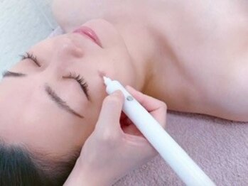 シンプル(Simple)の写真/【低刺激！シミ改善エステ】同時に美肌まで叶える欲張りケア！SNSで話題！ダウンタイムなしで理想のお肌に!