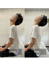 ナオル整体 池袋院(NAORU整体)/首のコリ感を楽に！【池袋整体】