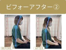 新潟関屋整骨院/ビフォーアフター２
