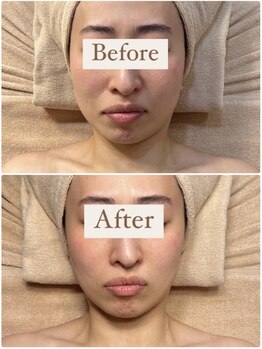 アンシャンテ(ENCHANTER)/フェイシャルマッサージ