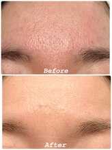 はだなの/敏感肌の方【透き通る透明肌に】