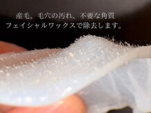 ケアズ(CARES)