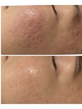 プレジール(Plaisir)/サーマトリックス