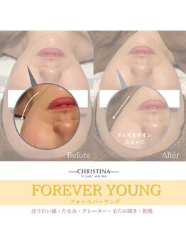 フルアナ(Hu ruana)/フェイシャルエステ