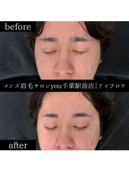 ユー 千葉駅前店(you)/ビフォ－アフター写真