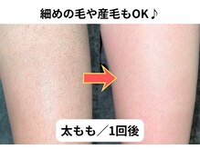 NTエステティック 西条店/