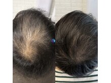 レイ(Rei)の雰囲気（山口県では希少！頭皮改善プロセルセラピーズ）