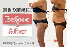 エーシーサロン 六本木店(acsalon)