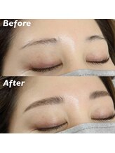 キンキー 広島(kinky)/