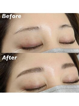 キンキー 広島(kinky)/