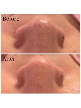 サロンジー(Salon Gee)/リゼネレートで毛穴ケア