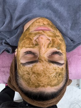 ジュジュ(JJ)の写真/ハーブピーリングでキメ細かなお肌に♪角質ケアと同時に有効成分を肌に浸透させ、輝くような美肌に◎