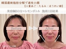 ネテマテ 表参道(netemate)の雰囲気（完全プライベート空間。リラックスした時間をお過ごしください。）