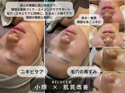 ベルーチェ(Beluce)の写真