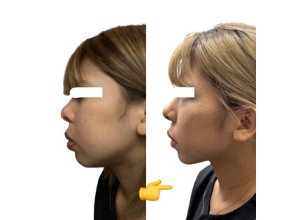 アイアム(I am)の写真