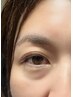似合わせまつげパーマ