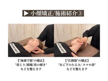 カラダコンシェルジュN(KARADAコンシェルジュN)/【小顔矯正】施術シーン紹介３
