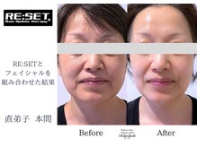 ディアスマイル(Dear.smile)/RE:SET＆フェイシャル