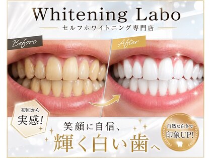 ホワイトニングラボ 八尾店(Whitening Labo)の写真