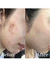 モット 神戸店(Motto)/フェイシャル 