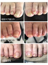 シェリエット(Cheriette)/