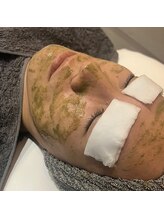 サムライビューティー 西新宿本店(SamuraiBeauty)/ツヤ肌！ハーブピーリング