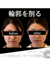 クリニカルボーテ 心斎橋院(CLINICAL BEAUTE)/小顔だけじゃないデザインも可能