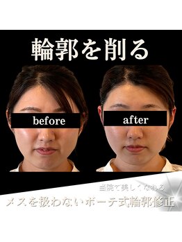 クリニカルボーテ 心斎橋院(CLINICAL BEAUTE)/小顔だけじゃないデザインも可能