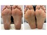 足裏角質ケア&トリートメントコース ¥5500→¥4500