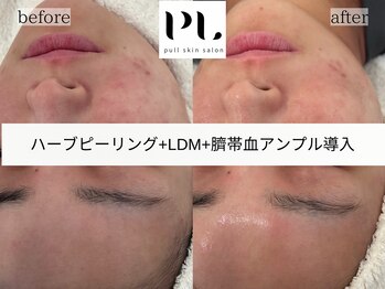 プル スキンサロン(pull skin salon)/