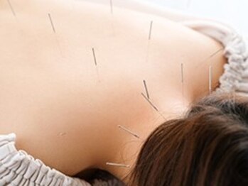 ハリシー鍼灸院の写真/鍼施術＋マッサージの組み合わせで、重だるい身体をスッキリ◎疲れが溜まっている方や肩こりにお悩みの方に