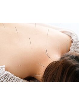 鍼灸施術を受けたい