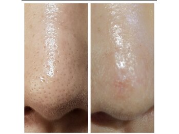 ティアラ(TIARA)/ララピール