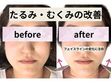 ゼン整体(ZEN)の雰囲気（男女問わずご利用頂けます。小顔/肩こり/痩身/リンパ/ヘッド）