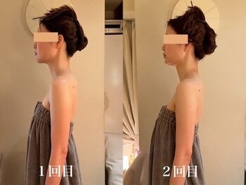 カオン(kaon)/ブライダルエステ2回のお客様