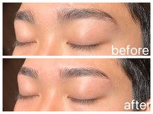 クラシックス(CLASSICS)/before&after