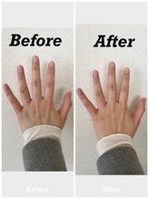 サンテ/指先美整　ハンドケア