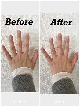 サンテ/指先美整　ハンドケア