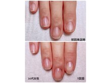 ピオニーネイル(peony nail)