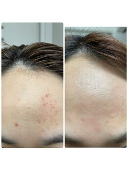 サロン シャイン(SHINE)/